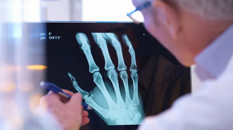 X-Ray